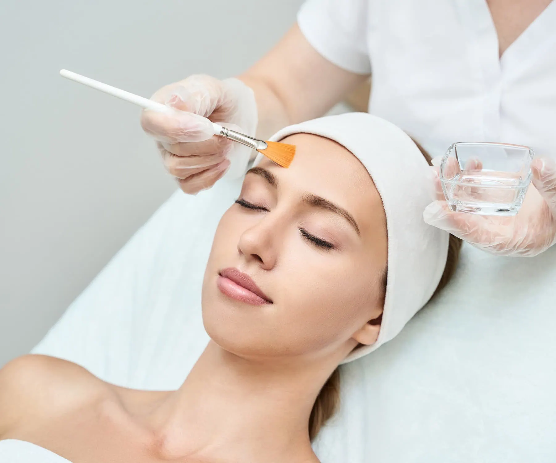 Chemical Peels Services