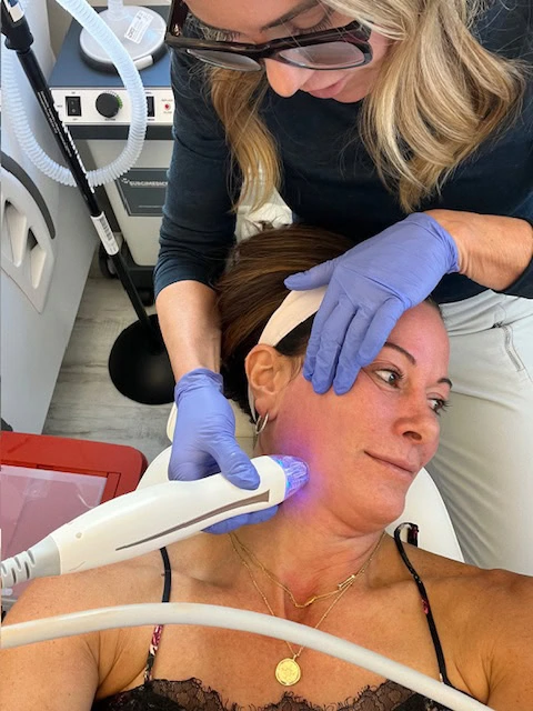 Woman Getting an RF-Microneedling Treatment | United Medical And Aesthetics in Wilmington, NC