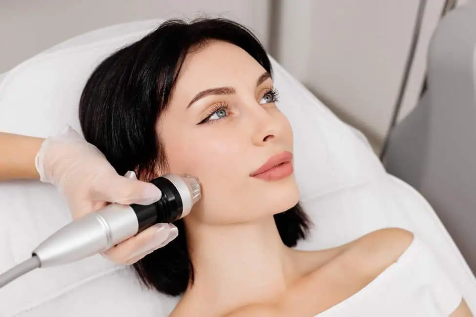 Virtue RF Microneedling